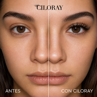 CILORAY™ Soft Muse