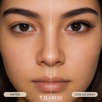 CILORAY™ Volume Muse